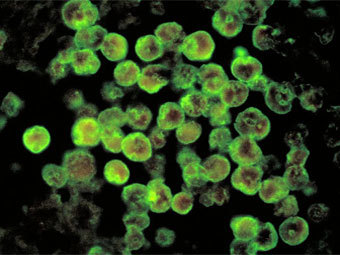 �������������� �����������������, ���������� Naegleria fowleri, ����������� � ����� wikipedia.org
