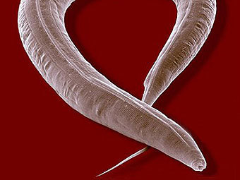 Круглый червь C. elegans. Фото с сайта space.gc.ca