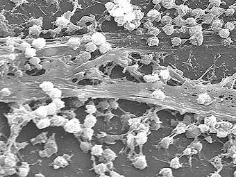 ��������� �������� Staphylococcus aureus. ���� CDC/ Rodney M. Donlan, Ph.D.; Janice Carr (PHIL #7488), 2005