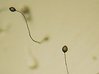 �������� ���� Dictyostelium discoideum. ���� ������������ Bruno in Colambus � ����� wikipedia.org