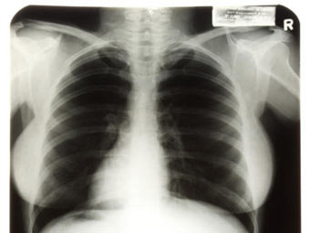 Рентгеновские снимки Монро ушли с молотка за 45 тысяч долларов
