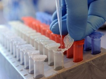 Исследование образцов сельскохозяйственной продукции в лаборатории в Гановере. Фото (c)AFP Исследование образцов сельскохозяйственной продукции в лаборатории в Гановере. Фото (c)AFP