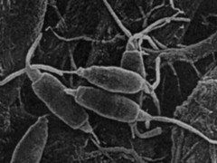 <i>Pestalotiopsis microspora</i> ���� � ����� http://www.capitanplaneta.com