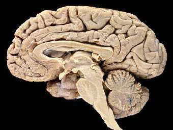 Мозг. Изображение с сайта csupomona.edu